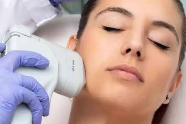 Image of woman having HIFU Rickmansworth treatment