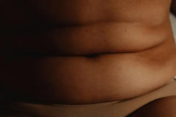 The Hidden Connection: How Stress Shapes Your Fitness and Body Composition 3 image of what stress can do on the stomach area and how Lipo 360 Rickmansworth can help to change your body shape.